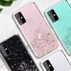 Shiny Glitter Case For Samsung - Premium Mobile Phone Cases from Dressmycell.com - Just $14! Shop now at Dressmycell.com Shiny Glitter Case For Samsung - Premium Mobile Phone Cases from Dressmycell.com - Just $14! Shop now at Dressmycell.com