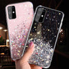 Shiny Glitter Case For Samsung - Premium Mobile Phone Cases from Dressmycell.com - Just $14! Shop now at Dressmycell.com Shiny Glitter Case For Samsung - Premium Mobile Phone Cases from Dressmycell.com - Just $14! Shop now at Dressmycell.com