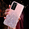 Shiny Glitter Case For Samsung - Premium Mobile Phone Cases from Dressmycell.com - Just $14! Shop now at Dressmycell.com Shiny Glitter Case For Samsung - Premium Mobile Phone Cases from Dressmycell.com - Just $14! Shop now at Dressmycell.com